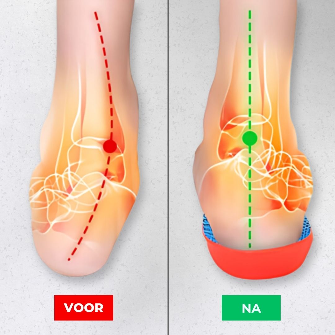 ComphySole Inlegzolen - Zeg Vaarwel Tegen Voetpijn